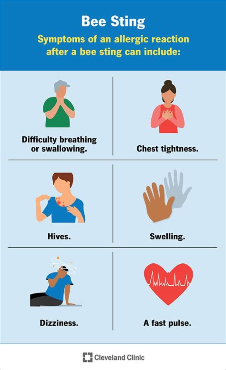 How do you avoid getting stung by a bee?