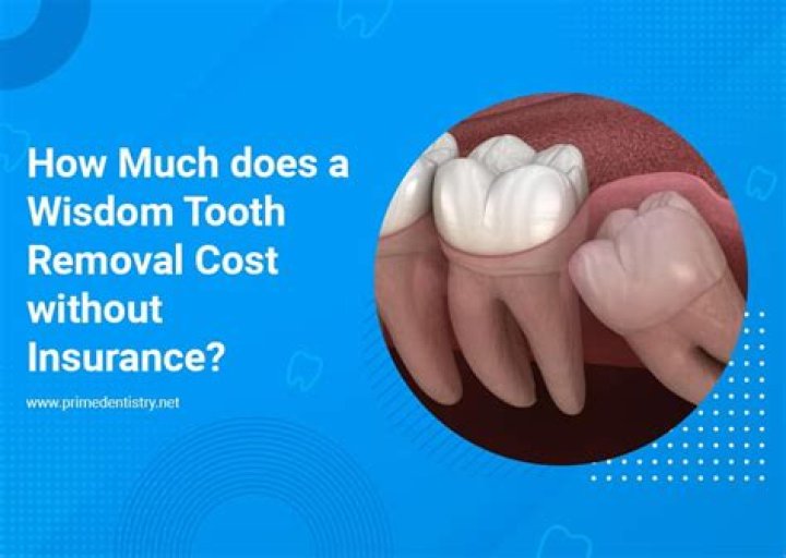 How much should a first tooth cost?